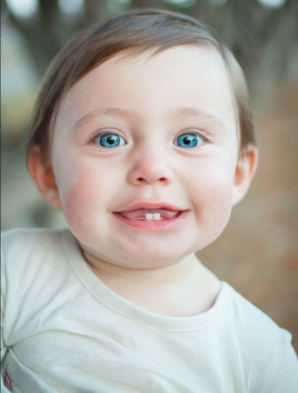 Debtal Associates of Decorah Post-Op Debtal Associates of Decorah Post-Op